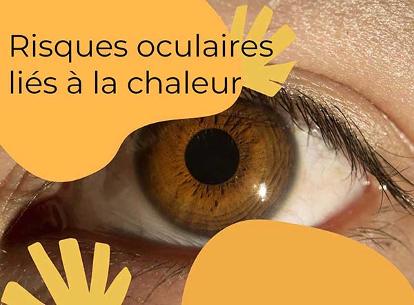 Risque oculaire lié à la chaleur