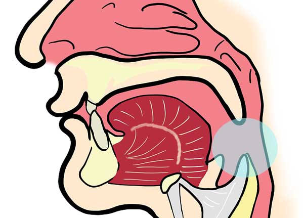 Sphère oropharyngée
